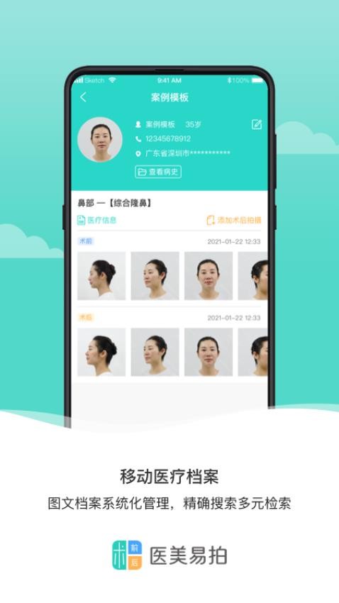 医美易拍app图2