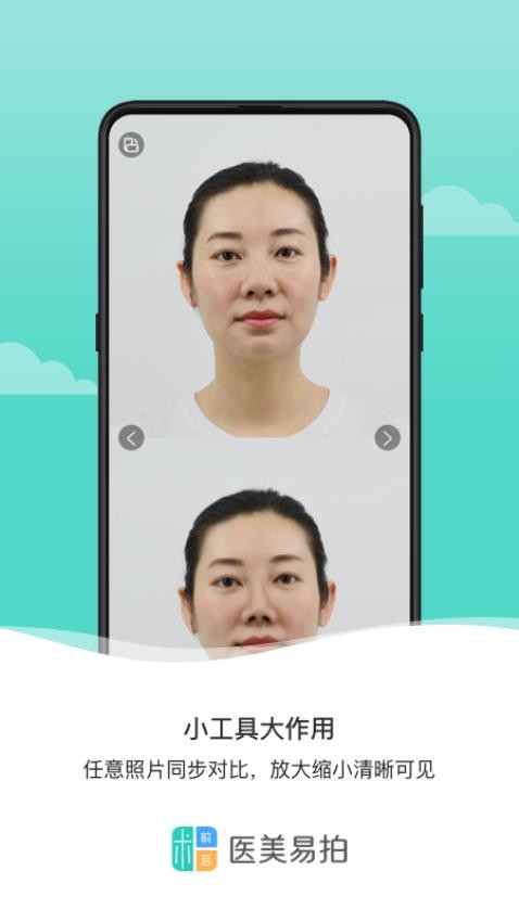 医美易拍app图3