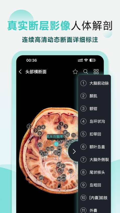 掌上3D解剖免费版图2